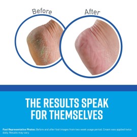 O\'Keeffe\'s K0320001-5 Healthy Feet Foot Cream in Jar (5 Pack), 3.2 oz