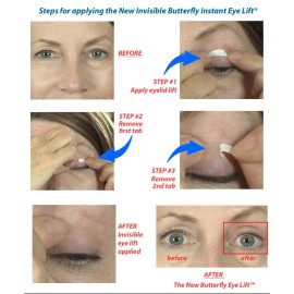 Butterfly Invisible Double Eye Lift Butterfly Invisible Double Eye Lift