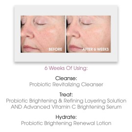 Gentle Exfoliating Toner & Chemical Exfoliant - Probiotic Brightening + Refining Layering Solution with Lactic, Azelaic, and Hyaluronic Acids for Radiant, Refined Skin Gentle Exfoliating Toner & Chemical Exfoliant - Probiotic Brightening + Refining Layering Solution with Lactic, Azelaic, and Hyaluronic Acids for Radiant, Refined Skin