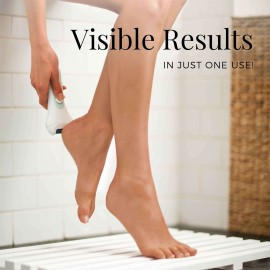 Remington Reveal Electronic Rotating Callus Remover with 2 Grit Heads (CR4000B) Remington Reveal Electronic Rotating Callus Remover with 2 Grit Heads (CR4000B)