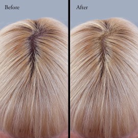 Root Touch Up and Concealer Powder - 11 True-to-Nature Shades - Zero Fragrance, Talc or Parabens - Hairline Powder With Brush by NuBeauti (Blonde) Root Touch Up and Concealer Powder - 11 True-to-Nature Shades - Zero Fragrance, Talc or Parabens - Hairline Powder With Brush by NuBeauti (Blonde)