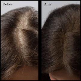 NuBeauti Root Touch Up Powder - True-to-Nature Hairline Concealer with 11 Shades - Fragrance-Free, Talc-Free, Paraben-Free (With Brush, Dark Brown) NuBeauti Root Touch Up Powder - True-to-Nature Hairline Concealer with 11 Shades - Fragrance-Free, Talc-Free, Paraben-Free (With Brush, Dark Brown)