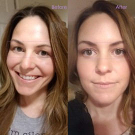 Invisible Lace Self-adhensive Fiber One-Sided Sticky Double Eyelid Tapes Stickers, Medical-use Breathable Fiber Instantly Eyelids Lift, Suitable for Hooded, Droopy, Uneven, Mono-eyelids