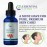 Essential Living: Organic Rosehip Oil - Cold-Pressed All-Natural Anti Aging Face Oil, Moisturizer, Hair and Nail Care and more - 1 oz. - Helps Minimize Scars, Wrinkles, and Blemishes