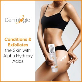 Anti-Acne Thigh & Buttocks Treatment - Clears Away Acne, Pimples, and Ingrown Hairs for the Buttocks and Thigh Area. Prevents Future Breakouts. 6.09 oz