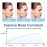 FERNIDA Nose Shaper Up Lifting Clip Nose Shaper for Wide Noses Beauty Nose Slimmer Device Pain Free High Up Tool