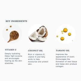 Promise Stretch Mark Prevention Bump Oil, Defense + Repair, Clean Pregnancy Skincare, Non-Toxic, Pregnancy Belly Oil, Vegan, Fast Drying Promise Stretch Mark Prevention Bump Oil, Defense + Repair, Clean Pregnancy Skincare, Non-Toxic, Pregnancy Belly Oil, Vegan, Fast Drying