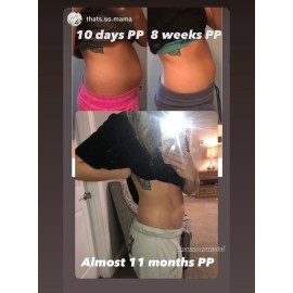 Promise Stretch Mark Prevention Bump Oil, Defense + Repair, Clean Pregnancy Skincare, Non-Toxic, Pregnancy Belly Oil, Vegan, Fast Drying Promise Stretch Mark Prevention Bump Oil, Defense + Repair, Clean Pregnancy Skincare, Non-Toxic, Pregnancy Belly Oil, Vegan, Fast Drying