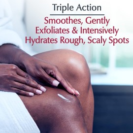 Eucerin Roughness Relief Spot Treatment, Urea Enriched Body Moisturizer for Dry Skin, Rough and Scaly Spots, With Precision Tip for Targeted Application, 2.5 Oz Tube