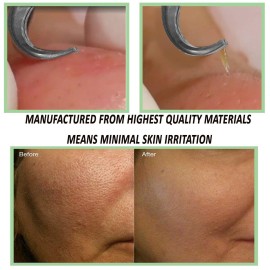 Blackhead Acne Extraction Tweezers - FEITA Pro & Surgical-Grade Stainless Steel Bend Curved Comedone Extractor Tweezer Tool for Remove Whitehead and Clogged Pores, Pimple - Pink