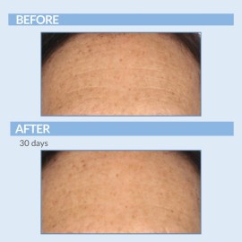 Retinol Anti-Aging Skin Care Set - Serum, Facial Moisture Cream & Face Wash - Smooth Fine Lines, Deep Wrinkles and Minimize Pores - Serious Skincare - 3 Piece Kit Retinol Anti-Aging Skin Care Set - Serum, Facial Moisture Cream & Face Wash - Smooth Fine Lines, Deep Wrinkles and Minimize Pores - Serious Skincare - 3 Piece Kit