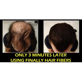 Hair Fiber Sprayer Shaker Bottle Kit with Shaker Bottle and Sprayer Top Attachment Included