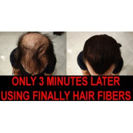 Hair Fiber Sprayer Shaker Bottle Kit with Shaker Bottle and Sprayer Top Attachment Included