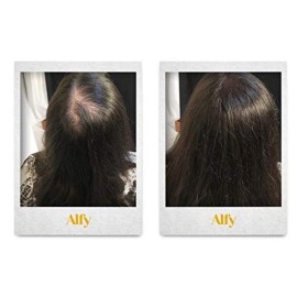 Alfy Hair Building Fibers for Thinning Hair, Medium Blonde, 12g