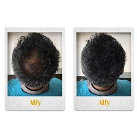 Alfy Hair Building Fibers for Thinning Hair, Gray, 12g