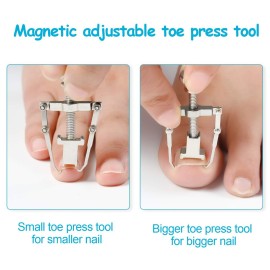 2 Pieces Ingrown Toenail Lifter Ingrown Toenail Tool Toe Clamp Stainless Steel Foot Care Tool for Paronychia (Silver) 2 Pieces Ingrown Toenail Lifter Ingrown Toenail Tool Toe Clamp Stainless Steel Foot Care Tool for Paronychia (Silver)
