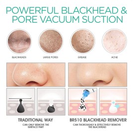 VOYOR Blackhead Remover Pore Vacuum - Electric Face Vacuum Pore Cleaner Acne White Heads Removal with Suction Heads (BR510)