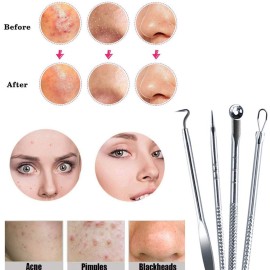 AKOAK 4 Pcs/Set Stainless Steel Acne Needle Set, Portable, Beauty and Makeup Tools, Professional Cleaning Face Acne, Blackheads
