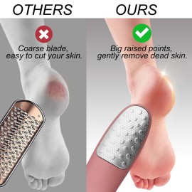 Foot Scrubber with Stand, Never-Cut-Your-Feet Foot File Callus Remover - Safe to Use | Comfortable Foot Scraper Feet Scrubber Dead Skin Remover, Best Home Pedicure Foot Care Tool, Used on Wet/Dry Feet Foot Scrubber with Stand, Never-Cut-Your-Feet Foot File Callus Remover - Safe to Use | Comfortable Foot Scraper Feet Scrubber Dead Skin Remover, Best Home Pedicure Foot Care Tool, Used on Wet/Dry Feet
