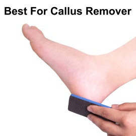 New AMT 12 PCS Pedicure Foot File Grit 60/60, Black Callus Remover File, Nail Files for Pets, Emery Boards for Pet Grooming, 60 Grit Foot File (12 PCS -Blue Center)