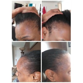 Kreyol Essence - Haitian Black Castor Oil for Skin and Hair, Glass Bottle - Cold Pressed Castor oil, Fuller-Looking Hair, Hexane Free, Natural Humectant Kreyol Essence - Haitian Black Castor Oil for Skin and Hair, Glass Bottle - Cold Pressed Castor oil, Fuller-Looking Hair, Hexane Free, Natural Humectant