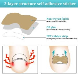 122 Pieces Ingrown Toenail Tool Set, Include Ingrown Toenail File and Lifter, 60 Pieces Elastic Patch Curved Toenails Brace Stickers and 60 Pieces Ingrown Toenail Correction Stickers