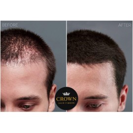 CROWN Hair Building Fibers Multipack (2 x 28g) - Instantly Cover Fine & Thinning Hair for a Thicker, Fuller Look - A Natural Keratin Concealer - 13 Shades for Men & Women - Light Brown