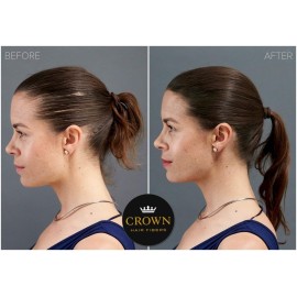 CROWN Hair Building Fibers Multipack (2 x 28g) - Instantly Cover Fine & Thinning Hair for a Thicker, Fuller Look - A Natural Keratin Concealer - 13 Shades for Men & Women - Light Brown