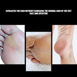 ZJchao Nail Drill Bits for Acrylic Nails & Pedicure Cone Bit, Foot Callus Remover with Nail Filing & Sanding Polishing Heads, Strong Hardness Stainless Steel for Manicure & Pedicure