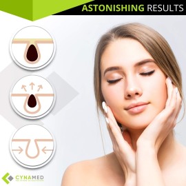 Blackhead Tweezer - Professional Curved Steel Tip Surgical Comedone & Splinter Extractor. Ideal Blemish & Acne Remover Tool Means Flawless Facial Skin (Yellow)