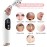 Blackhead Remover Pore Vacuum with Hot Compress- 2025 Upgraded Electric Face Cleaner Pore Extractor Pimple Extractor Acne White Heads Removal Tool with 5 Suction Head LCD Screen and Base