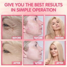 TUMAKOU Portable High Frequency Facial Machine - Orange High Frequency Face Skin Wand Device TUMAKOU Portable High Frequency Facial Machine - Orange High Frequency Face Skin Wand Device