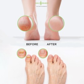 DAILY REMEDY Foot Soak Salts- Variety Pack of 4- Tea Tree Oil, Muscle Relief, Calming Lavender & Citrus Soak- For Foot Pain, Soreness, Athletes Foot, Odors, Calluses-Made In USA