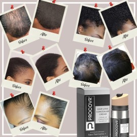 PROCOVR The ORIGINAL Thinning Hair and Hairline Concealer, Natural Hair Mascara for Balding Areas, Root Touch-Up for Thicker Appearance (Natural Brown FBA) PROCOVR The ORIGINAL Thinning Hair and Hairline Concealer, Natural Hair Mascara for Balding Areas, Root Touch-Up for Thicker Appearance (Natural Brown FBA)