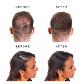 PROCOVR The ORIGINAL Thinning Hair and Hairline Concealer, Natural Hair Mascara for Balding Areas, Root Touch-Up for Thicker Appearance (Natural Brown FBA) PROCOVR The ORIGINAL Thinning Hair and Hairline Concealer, Natural Hair Mascara for Balding Areas, Root Touch-Up for Thicker Appearance (Natural Brown FBA)