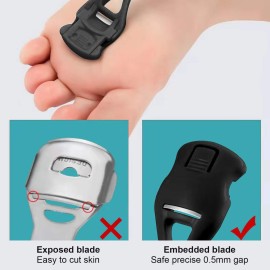 Foot Care Pedicure Callus Shaver Hard Skin Remover, Sichy Heel Scraper for Feet, 10 Replacement Slice 1 Stainless Steel Callus Shaver Foot Care Tools Hard Dry Skin Remover for Hand Feet Foot Care Pedicure Callus Shaver Hard Skin Remover, Sichy Heel Scraper for Feet, 10 Replacement Slice 1 Stainless Steel Callus Shaver Foot Care Tools Hard Dry Skin Remover for Hand Feet