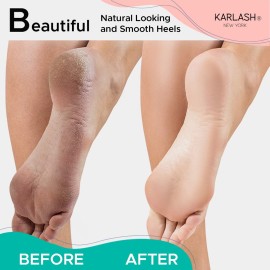 Karlash Professional Pedicure Foot Pumice Stone for Feet Skin Callus Remover and Scrubber for Dead Skins 2 Sided (Pack of 1)