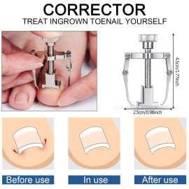 15 Pieces Ingrown Toenail Tools Stainless Steel Foot Nail Tools, Toenail File and Lifter, Nail Clipper, Cuticle Cutters, Cuticle Pusher and Manicure Pedicure Tools for Ingrown and Thick Nail (Red)