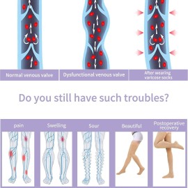 Athbavib 20-30mmHg Thigh High Compression Stockings for Women & Men, Closed Toe Medical Compression Socks Graduated Support Compression Sock for Varicose Veins Swelling Treatment Athbavib 20-30mmHg Thigh High Compression Stockings for Women & Men, Closed Toe Medical Compression Socks Graduated Support Compression Sock for Varicose Veins Swelling Treatment
