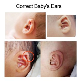 ZJchao Ear Corrector, 4 X 50cm Silicone Newborn Baby Ear Aesthetic Correctors Kids Infant Protruding Ear Patch Stickers Infant Protruding Ear Patch Stickers for Babies with Protruding Ears