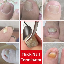 QSEEL Stainless Steel Nail and Toenail Clippers for Elderly People, Thick-nail or Sick-nail Users, Labor-saving Arc Nail Clipper with Comfortable Handle Gripper (Red) QSEEL Stainless Steel Nail and Toenail Clippers for Elderly People, Thick-nail or Sick-nail Users, Labor-saving Arc Nail Clipper with Comfortable Handle Gripper (Red)