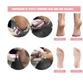Electric Foot File Callus Remover Professional Foot File Pedicure Tools Adjustable Speed 60pcs Replacement Sandpaper disc Easy to Remove Cutin Dead Skin calluses(Black 60pcs)