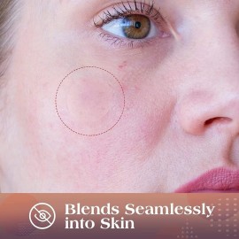 AUSLKA Blemishes Patches -175 Patches - Hydrocolloid Spot Dots - Blemishes Patch - Pimple Stickers, For Face Absorbing Cover Patch