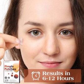 AUSLKA Blemishes Patches -175 Patches - Hydrocolloid Spot Dots - Blemishes Patch - Pimple Stickers, For Face Absorbing Cover Patch