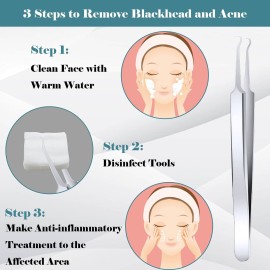 ANCIRS 6 Pack Acne Pimple Blackhead Remover Tweezers, Stainless Steel Acne Tweezers, Curved Pimple Tweezers Extractors Tool for Blackhead Blemish Removal-Silver Color ANCIRS 6 Pack Acne Pimple Blackhead Remover Tweezers, Stainless Steel Acne Tweezers, Curved Pimple Tweezers Extractors Tool for Blackhead Blemish Removal-Silver Color