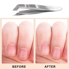 Mini Nail Cuticle Trimmer Kit Cuticle Nipper Cutter Nail Polish Pusher Cuticle Peeler Scraper Perfect for Hang nails - for Fingernails and Toenails(1 Pack) Mini Nail Cuticle Trimmer Kit Cuticle Nipper Cutter Nail Polish Pusher Cuticle Peeler Scraper Perfect for Hang nails - for Fingernails and Toenails(1 Pack)