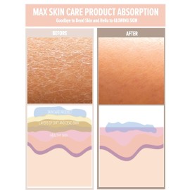 SAERO Exfoliating Glove (1pc) - 100% Vegan Viscose Body Scrub Glove - Traditional Kessa Korean Washcloth - Ideal for Self-Tan Removal & Keratosis Pilaris Treatment