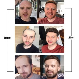 Lordhair Hair System for Men with Human Hair 8x10 inch Hairpiece for Men 0.06mm Super Thin Skin Mens Hair system All V-looped Mens Toupee Off Black 1B with 5% grey hair Lordhair Hair System for Men with Human Hair 8x10 inch Hairpiece for Men 0.06mm Super Thin Skin Mens Hair system All V-looped Mens Toupee Off Black 1B with 5% grey hair