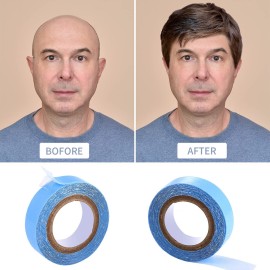 Sacubee 4 Rolls Lace Front Wig Tape Waterproof Strong Adhesive Double Sided Wigs Tape Lace Front Support Tapes Hairpiece Tapes for Wig Hair Extension(1 cm and 0.8 cm,Blue) Sacubee 4 Rolls Lace Front Wig Tape Waterproof Strong Adhesive Double Sided Wigs Tape Lace Front Support Tapes Hairpiece Tapes for Wig Hair Extension(1 cm and 0.8 cm,Blue)