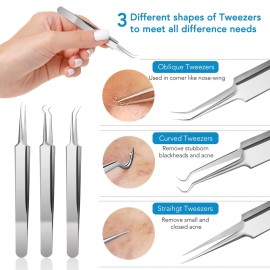 Blackhead Remover, Pimple Popper Tool kit, Blemish,Whitehead, Acne and Zit Removal, Pimple Extractor Tools with Metal Case Blackhead Remover, Pimple Popper Tool kit, Blemish,Whitehead, Acne and Zit Removal, Pimple Extractor Tools with Metal Case